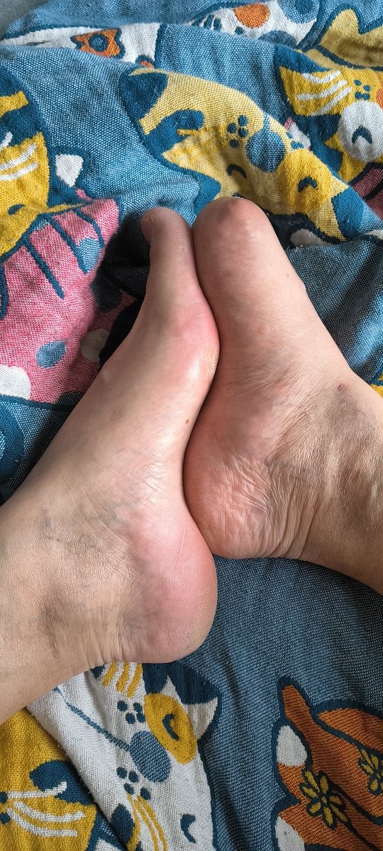 Man with small feet tweet media