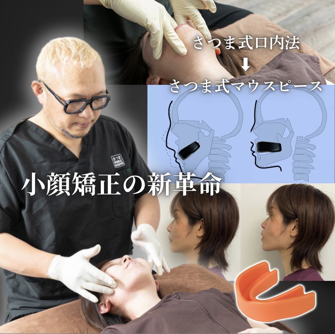 さつま式の小顔矯正は、口内から顎を整え美しい整顔を実現。 さらに