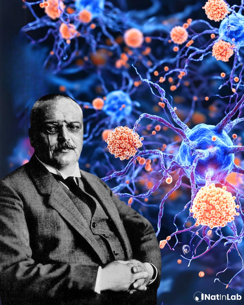 NatInLab1's tweet photo. The man behind a name of #Alzheimer disease was Alois, born 14/06/1864, a German psychiatrist and neuropathologist, who made a contribution to the field of #neurodegenerative disorders. He identified the presence of #amyloid plaques and neurofibrillary #tangles in patient’s 🧠 https://t.co/Po3DIgOAOO