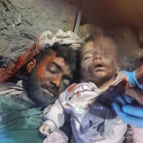 jacksonhinkle's tweet photo. 🚨🇮🇱 ZIONIST PROPAGANDA

❌ Baby is totally clean
❌ Baby is unscathed
❌ No rescue gear 

⬇️🇵🇸 This is what it ACTUALLY looks like when a baby is pulled from the rubble of a BOMBING! https://t.co/G8HLy7g3PC