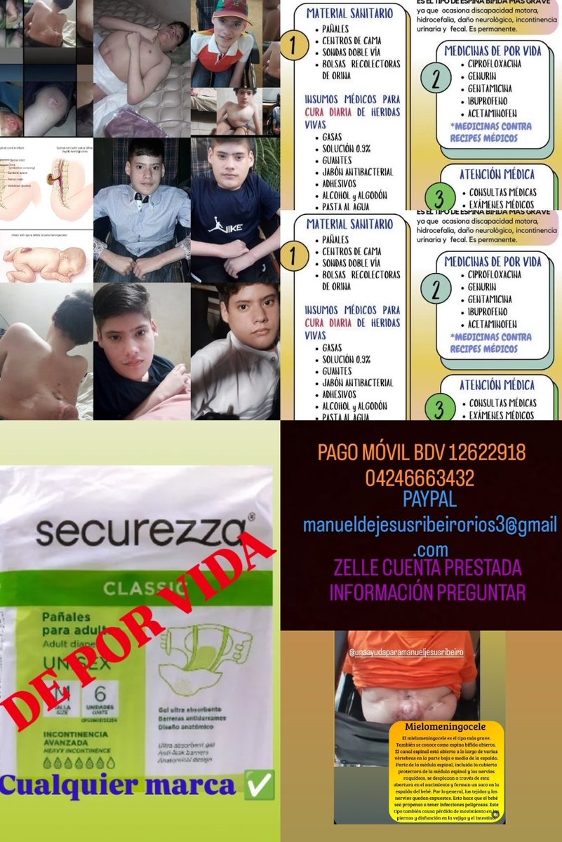manuel02101's tweet photo. Hola 👋 soy Manuel Ribeiro un joven Zuliano con discapacidad, Displasia de las caderas, mielomeningocele, espina bífida, vejiga neurogénica, hidrocefalia, agradezco a quienes puedan ayudar, mí caso es de por vida,no contamos con recursos económicos muchas gracias de antemano. https://t.co/veBcwcGtlu