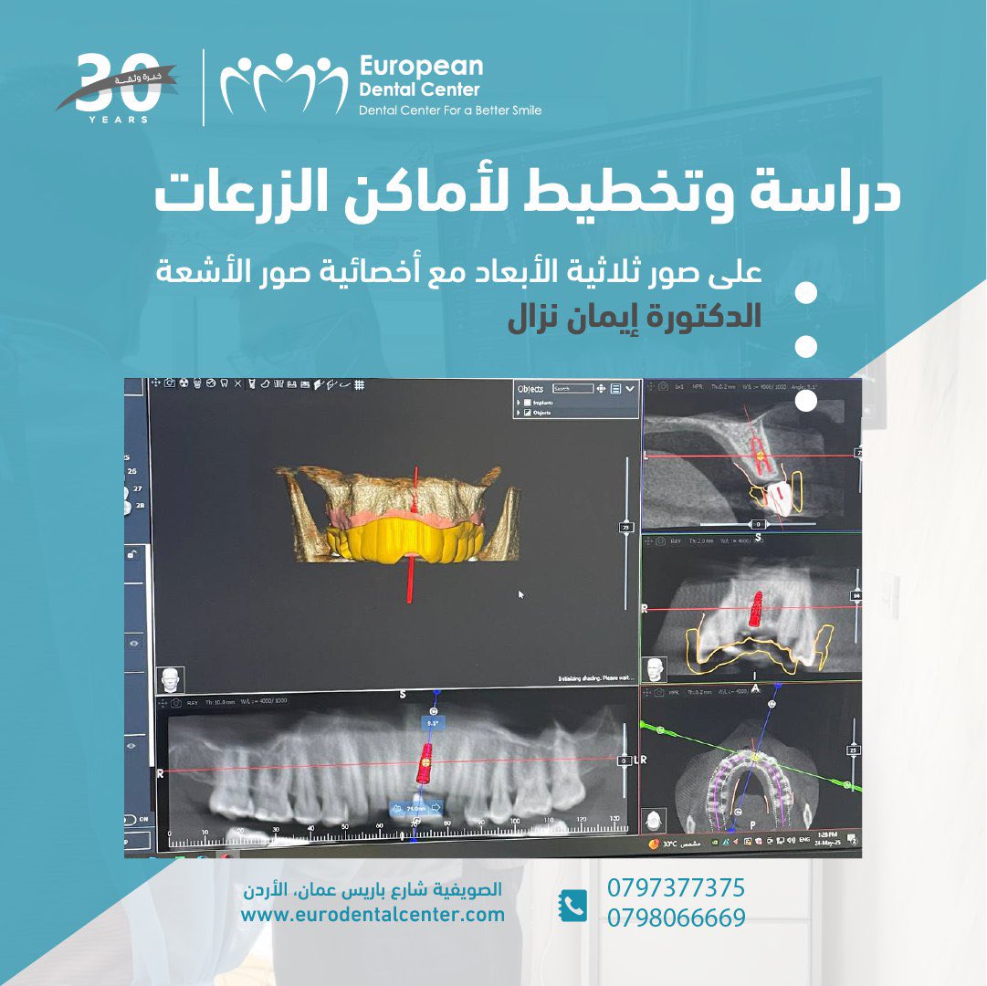 احصل على نتائج مضمونة وابتسامة مثالية مع الزراعة الموجهة بالحاسوب في المركز الأوروبي لطب الأسنان
" مع الخبرة والإتقان نصنع الفرق ونزرع الثقة لدى مراجعينا "
مزايا زراعة الأسنان لدى المركز الأوروبي :
✅  30 عام من الخبرة في زراعة الأسنان 
✅ وجود فريق عمل كامل واخصائيين متخصصين في