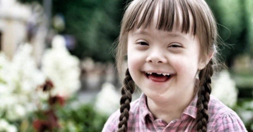 En Islandia se elimina al 100% de los embriones con #síndromedeDown. En España, el 88%. Hitler dijo: "La destrucción de los niños deformes es más decente y más humana que la miserable locura de dejarlos vivir". La eugenesia se abre paso, disfrazada de progreso. 
#SiAlaVida