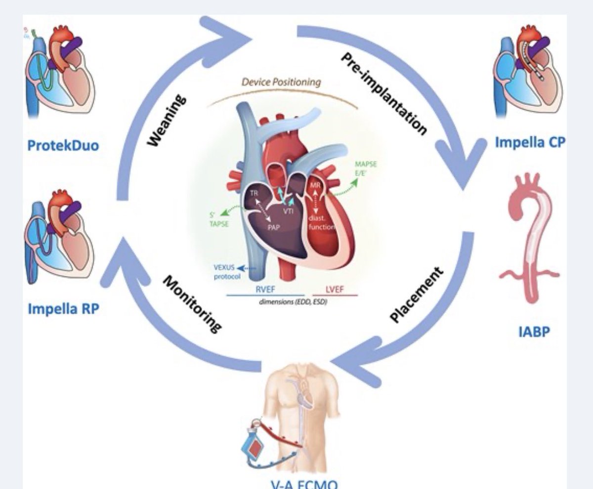 EHJ-IMP Editor-in-Chief (@ehjimpeic) on Twitter photo #Echofirst in short term MCS #EHJIMP
✅ Comprehensive, practical guide for clinicians on the echocardiographic assessment of commonly used stMCS devices, including intra-aortic balloon pump, Impella, ProtekDuo and VA-ECMO ➡️ academic.oup.com/ehjimp/article… <a href="/ESC_Journals/">European Society of Cardiology Journals</a> <a href="/escardio/">European Society of Cardiology</a> #Echofirst in short term MCS #EHJIMP
✅ Comprehensive, practical guide for clinicians on the echocardiographic assessment of commonly used stMCS devices, including intra-aortic balloon pump, Impella, ProtekDuo and VA-ECMO ➡️ academic.oup.com/ehjimp/article… <a href="/ESC_Journals/">European Society of Cardiology Journals</a> <a href="/escardio/">European Society of Cardiology</a>