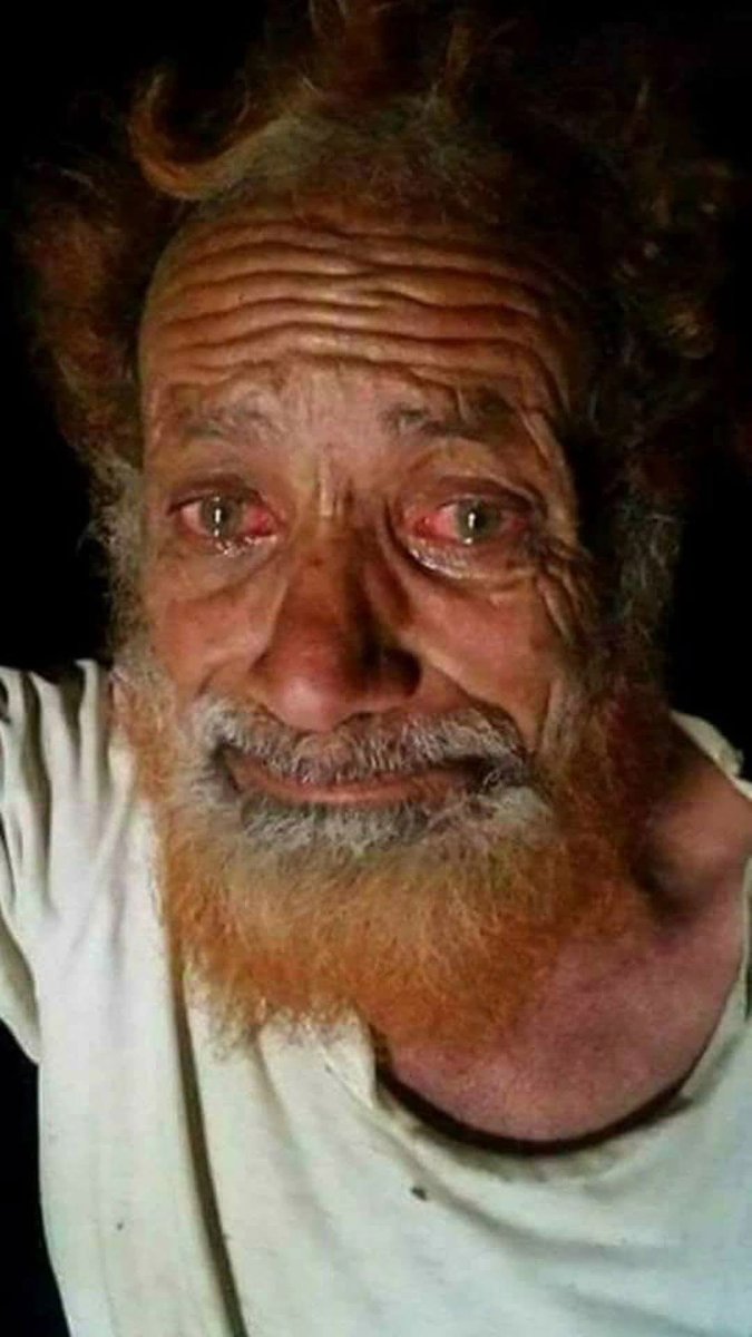 لا تُنسِكُم صَخَبُ حربِ إيرانَ وإسرائيلَ عنِ الحربِ الصامتةِ، تلكَ التي يَتجرّعُ غُصَصَها المواطنُ اليمنيُّ كلَّ يومٍ، صباحًا ومساءً، شَمالًا وجنوبًا، شرقًا وغربًا؛ إنَّها حربُ الفقرِ، والقهرِ، والموتِ البطيءِ.
ُهذَةِ حرَبّ_ تأكُلُ الأخضرَ واليابسَ؛
الُسِلامٌ لُوطِنيَ الُجرَيحُ