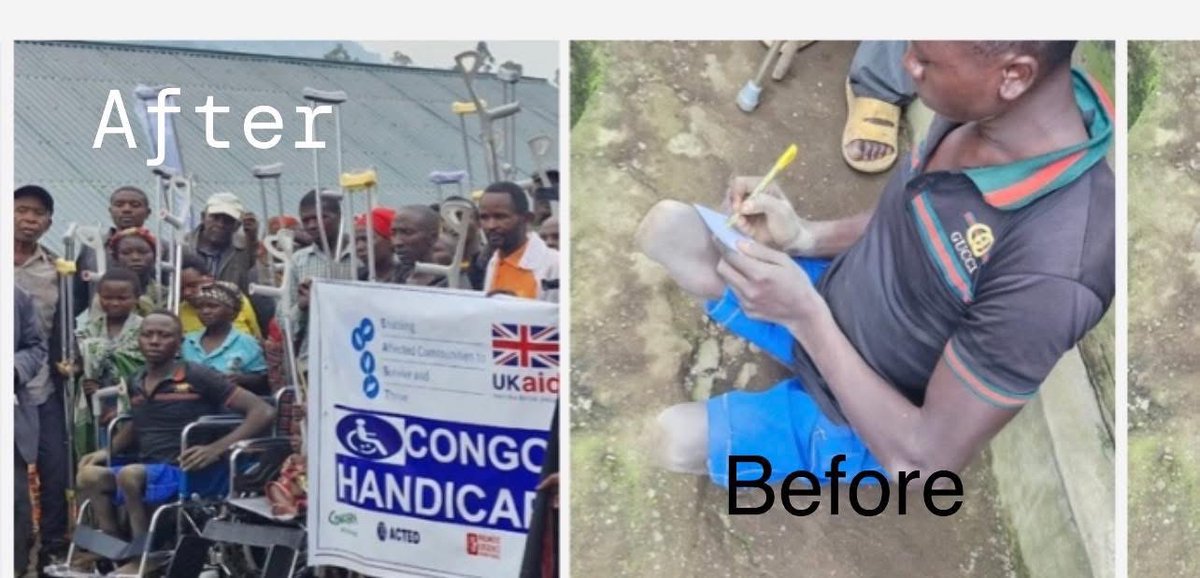 Congo Handicap (@congohandicap) on Twitter photo Soutenu par <a href="/UKinDRC/">UK in DRC</a> <a href="/FCDOGovUK/">Foreign, Commonwealth & Development Office</a> Congo Handicap s’est engagé à apporter son aide là où elle sera nécessaire afin de briser le cycle de la discrimination aux familles ou individus vivant avec un handicap et soutient ceux qui ne peuvent ni se déplacer ni prendre soin d'eux-mêmes Soutenu par <a href="/UKinDRC/">UK in DRC</a> <a href="/FCDOGovUK/">Foreign, Commonwealth & Development Office</a> Congo Handicap s’est engagé à apporter son aide là où elle sera nécessaire afin de briser le cycle de la discrimination aux familles ou individus vivant avec un handicap et soutient ceux qui ne peuvent ni se déplacer ni prendre soin d'eux-mêmes