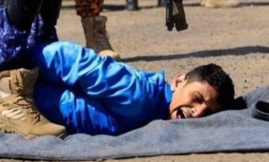 دماء هذا القاصر التهامي المظلوم كفيلة بزلزلة عروش عصابات الانقلاب الزيدية وإن غداً لناظره قريب!

#ساحل_تهامة
#الساحل_التهامي