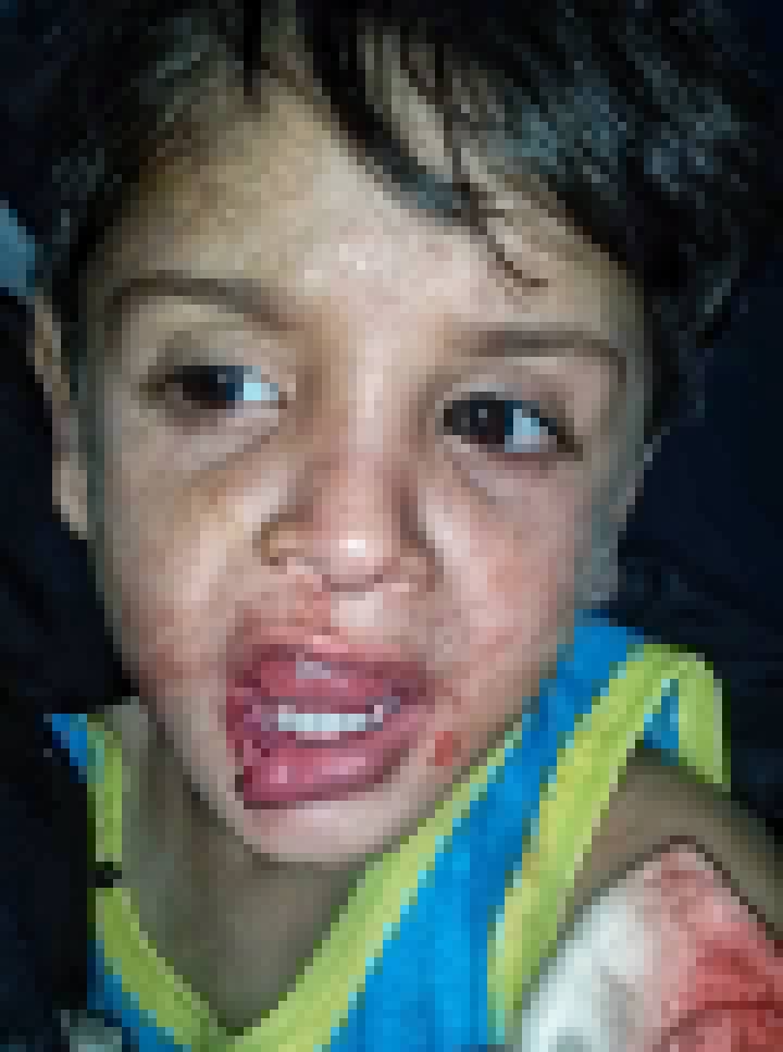 rv20g__'s tweet image. *Urgent appeal:* My child was injured in the bombing and is undergoing emergency surgery. We need your support to secure his treatment. Every bit of assistance saves a life. 🙏💙
Please help me.💔💔

social.fund/hbnocf/?sw=2