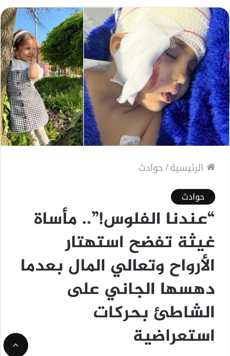 anas_freevoice's tweet photo. فينما كان شي كل.ب عندو لفلوس وتلقاه جامعهم بالريع او المخدرات وكيدير شي جر.يمة بحال الحيوا.ن الذي دهس الطفلة غيثة بسيارة دفع رباعي على شاطىء سيدي رحال.. 
اول جواب: عندي لفلوس.. واش عرفتو شكون انا.. ديرو ما في جهدكم.. 🤮🤮🤮
اب غيثة قال ان عائ��ة الحيوا.ن قالوا له "عندنا لفلوس". https://t.co/93ZJJNE4cw