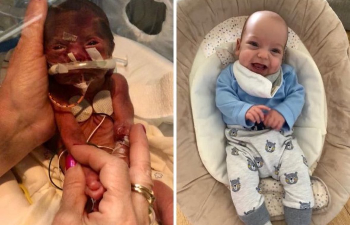 Meet Alfie.

He was born premature at 26 weeks.

He is not a “clump of cells”

He is a human being worthy of life.