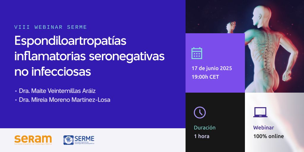 SERAM - Sociedad Española de Radiología Médica (@seram_rx) on Twitter photo ¡Nuevo webinar <a href="/MskSerme/">SERME</a> en #FormaciónSERAM! 📚 Durante esta sesión se tratará de proporcionar a los radiólogos el conocimiento de las diversas enfermedades inflamatorias crónicas que forman el grupo de las Espondiloartropatías
📅 El próximo 17 de junio a las 19.00h CET 
Más ¡Nuevo webinar <a href="/MskSerme/">SERME</a> en #FormaciónSERAM! 📚 Durante esta sesión se tratará de proporcionar a los radiólogos el conocimiento de las diversas enfermedades inflamatorias crónicas que forman el grupo de las Espondiloartropatías
📅 El próximo 17 de junio a las 19.00h CET 
Más