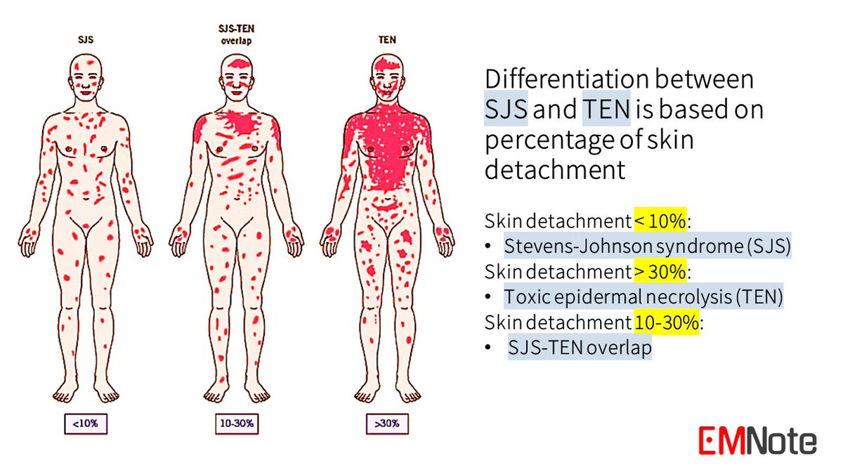 💢 Most common medications that can cause Stevens-Johnson syndrome/TEN (Toxic Epidermal Necrolysis):💊💊
A rare but deadly skin reaction — often drug-induced.

🔘Allopurinol
🔘Sulfa antibiotics (e.g. TMP-SMX)
🔘Anticonvulsants: Carbamazepine, Phenytoin, Lamotrigine,Phenobarbital