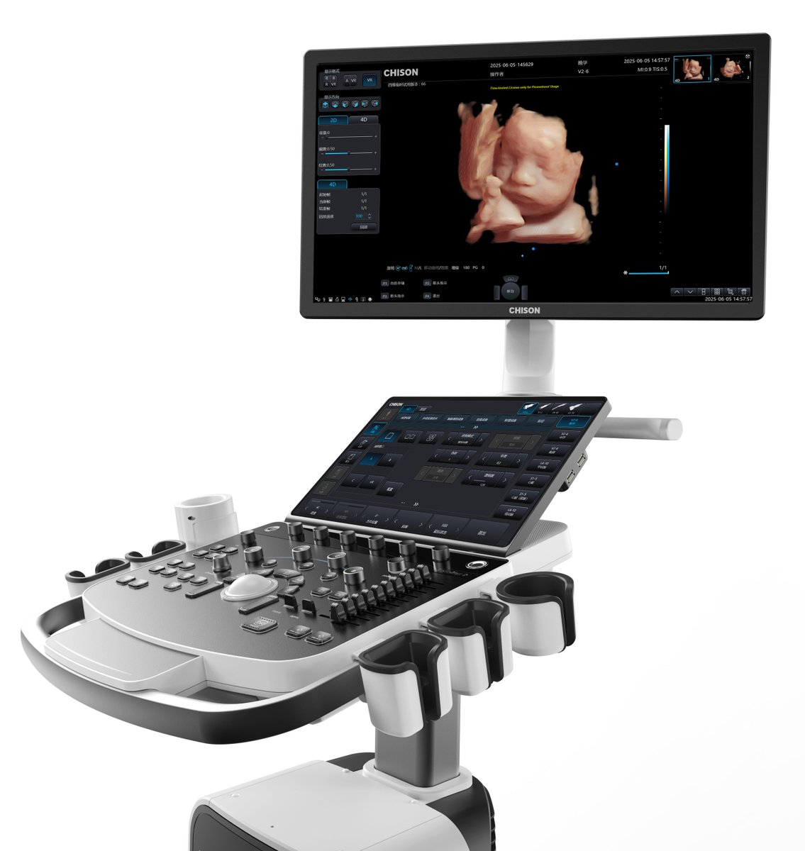 chisonmedical's tweet image. Precision in Practice! ✨
The SonoMax's advanced imaging technology brings new confidence to first-trimester screening. Early detection starts with superior ultrasound!
#PrenatalImaging #OBUltrasound #NTscan #CHISON