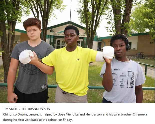 This Black child survived a sword attack by another 16-year old and instead of using this as an example for addressing systemic issues, the premier of Manitoba wants to bring back school police officers after they were removed for putting similar children in more harm. 1/10