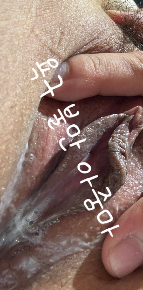 왁싱 햇을때라 구멍이 적나라하게 보여
가릴까 햇지만 여러분들이 싫어할거 같아서..

하트 눌러주시는분 풀영상 쏠게요!