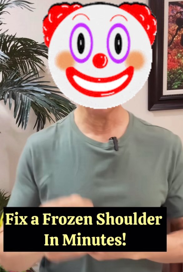 🚨🐂 💩 🚨 

Some so called ‘therapists’ claim they can fix ‘Frozen Shoulder’ in minutes‼️👀

Wow! 🫣

Sure…conservative treatment can be effective with ⬇️ night pain in 1 month &amp; ⬆️ motion within a year

sciencedirect.com/science/articl…

Not 👉 In Minutes! 🤨

#BeAware #Lotsof💩💩💩
