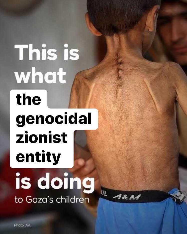I’m #PALESTINE 🇵🇸 More than 93 % of children in #Gaza ( around 930.000 ) are now at critical risk of FAMINE. So... If the “macron - merz - meloni - starmer” quartet makes counter-logical decisions by supporting the genocidal zionist entity, then let these G4 representatives speak