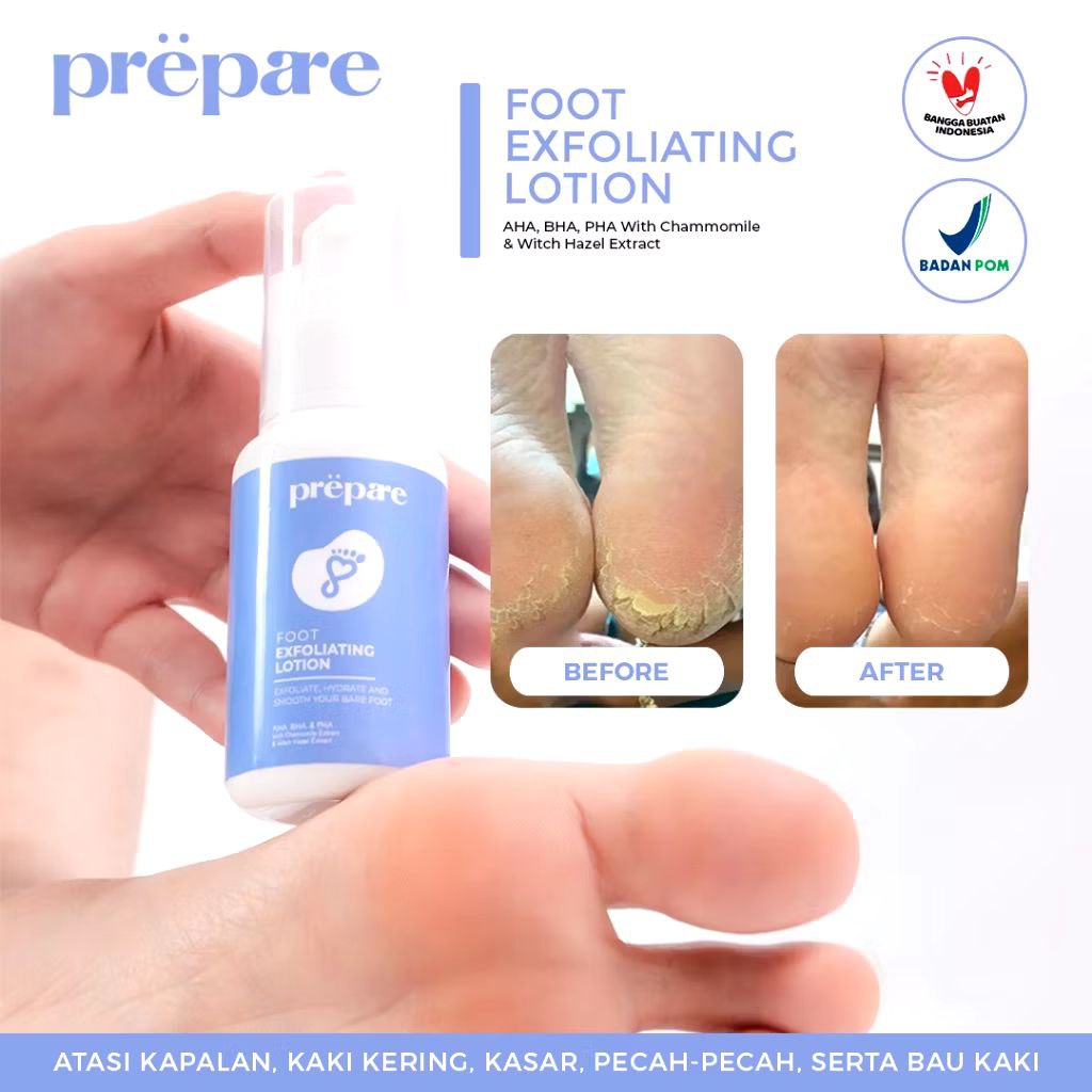 Penghilang Kaki Kapalan Pecah-Pecah

s.shopee.co.id/ySyKv0Gi