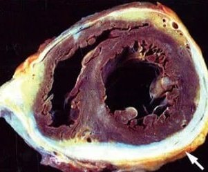 What is the diagnosis ⁉️