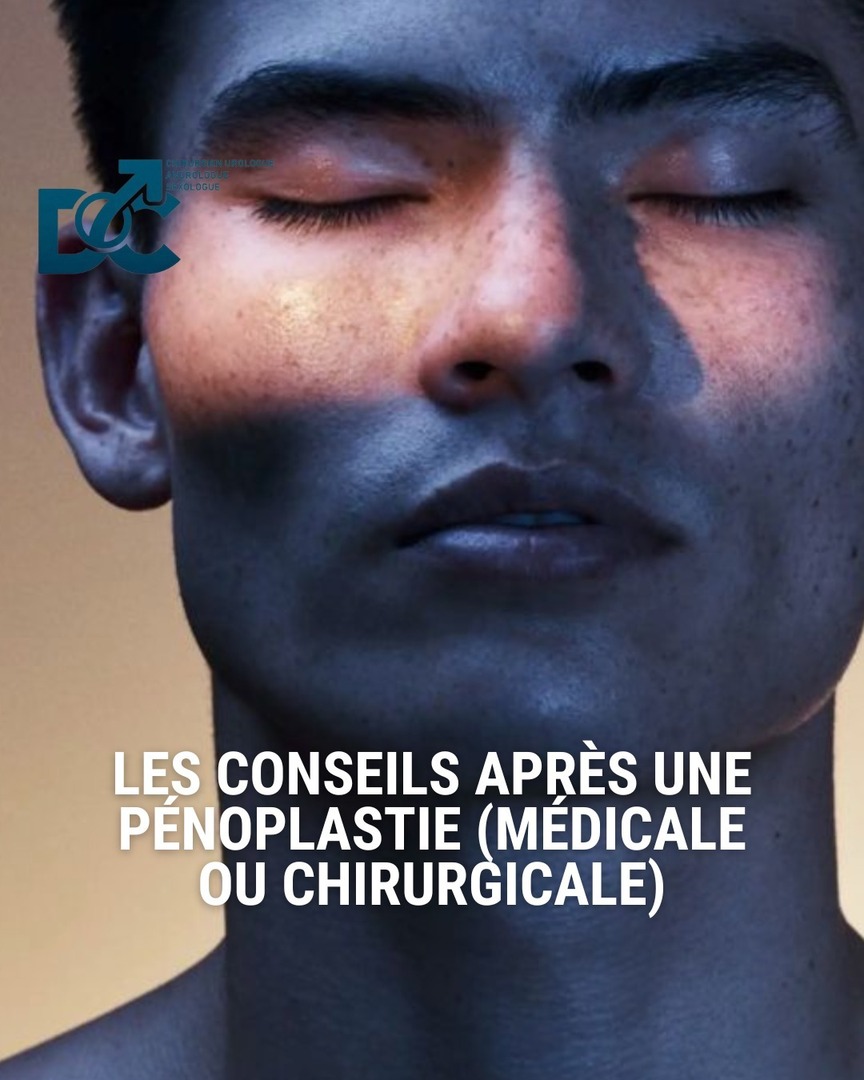 LES CONSEILS APRÈS UNE PÉNOPLASTIE (MÉDICALE OU CHIRURGICALE) :

🛌 Repos &amp; hygiène :
✅ Repos relatif pendant 48 à 72h
✅ Toilette intime douce (eau tiède, savon neutre)
✅ Séchage délicat sans frotter

🚫 Activités à éviter :
⛔️ Pas de rapports sexuels… instagr.am/p/DK6tfovtNX0/