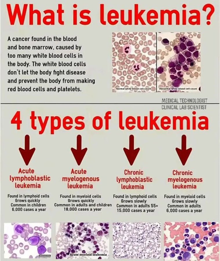 Leukaemia 🩸

✨✨✨
