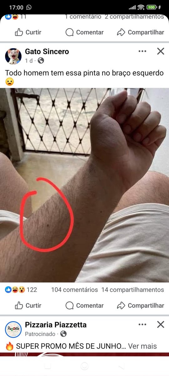 Todo homem tem esta pinta no braço esquerdo.