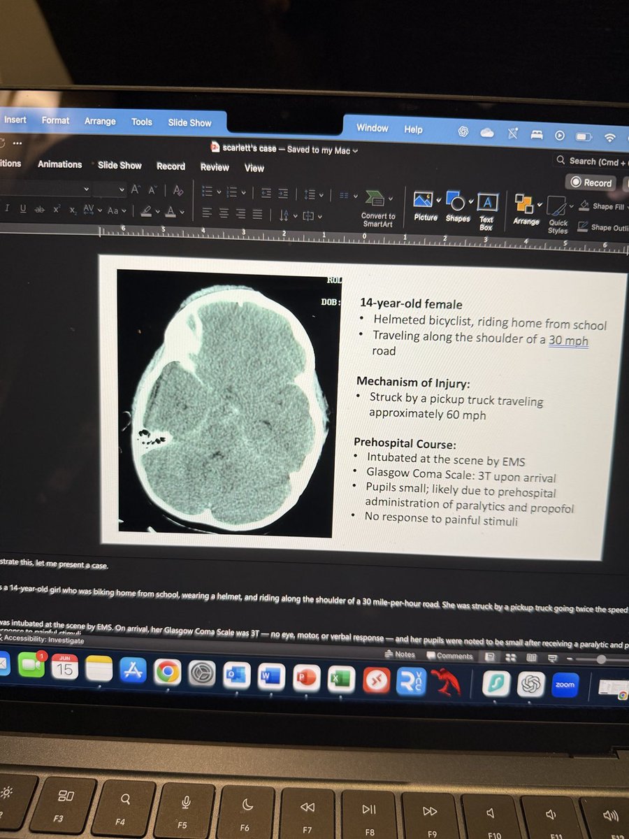 DrSamadani's tweet image. Getting ready to present my first talk @AANSCNStrauma in #philadelphia - why drill holes in the skull when you can get more physiological data from noninvasive cranial nerve assessment?