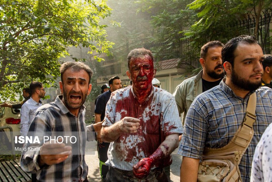 Israel is not targeting military sites — it is targeting people.
Women, children, and ordinary civilians are being killed in their homes, hospitals, and streets.
This is not self-defense. This is a war crime.
#IranUnderAttack #WarCrimes #CiviliansUnderFire #Israel