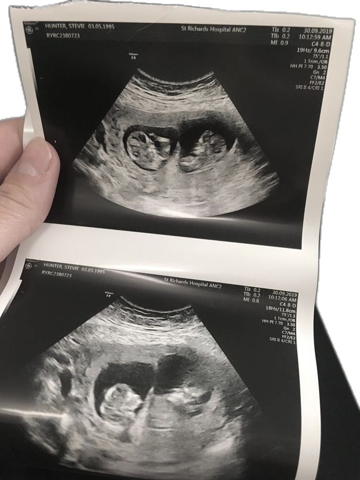 feliz primer día del padre 💘 te amo mi amor, vas a ser el mejor papá para nuestra nenita y nuestro nenito