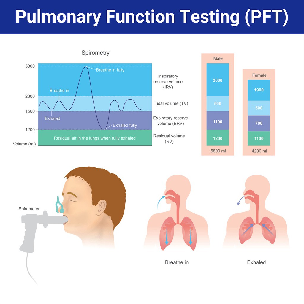 RespiratoryZone's tweet image. Which of the following methods of lung volume determination correlates best with body plethysmography in patients with obstructive diseases? ✔️ bit.ly/4bCBOw9