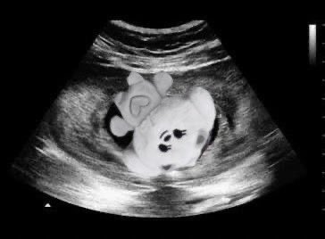 kitgyuz's tweet photo. happy fathers day to beomgyu! https://t.co/mP9fvv5G0j
