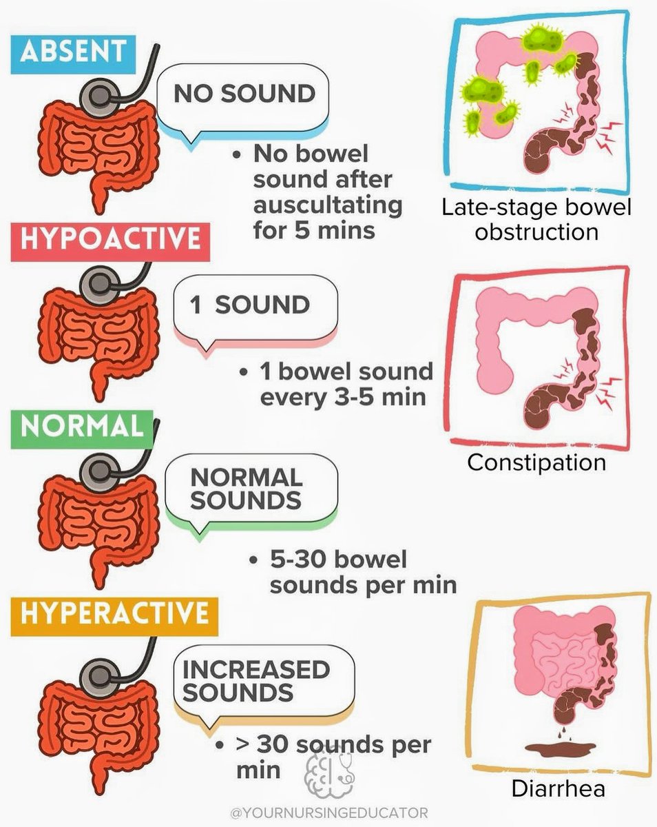 Bowel sounds.. or lack of sounds