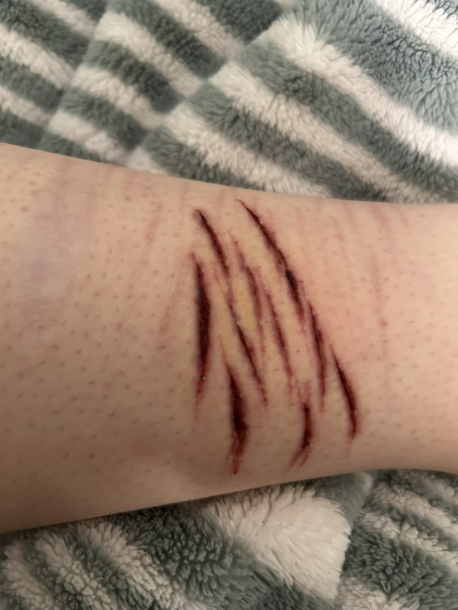 d3adrabb1tt's tweet photo. Healing https://t.co/yPUaUep3E0