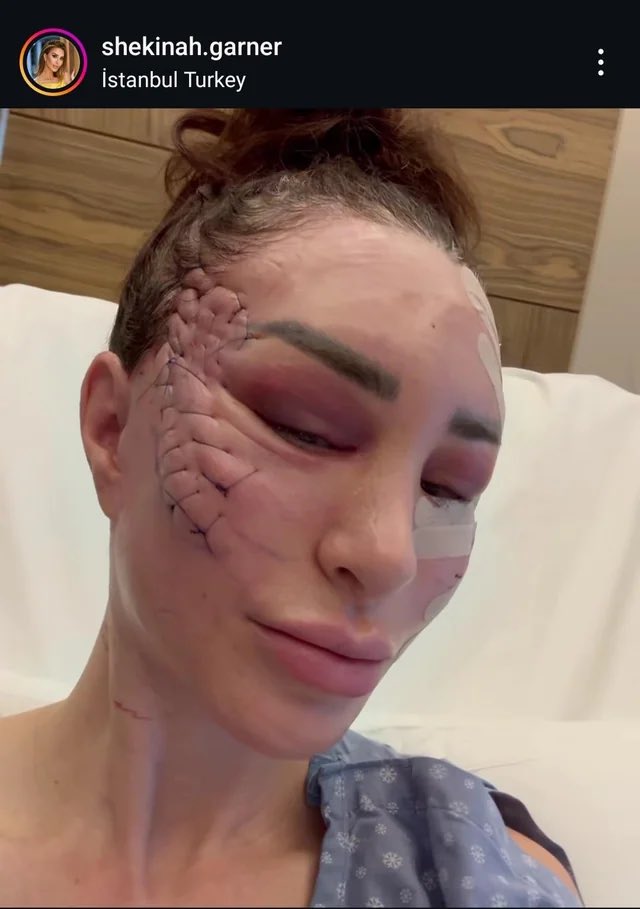 If I had to wake up to a different version of Frankenstein every day I’d have nightmares too 
#90DayFiance