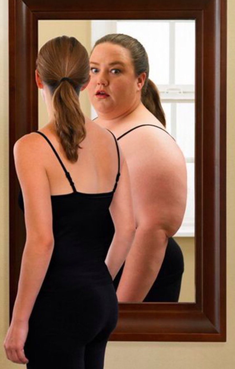 what body dysmorphia is like