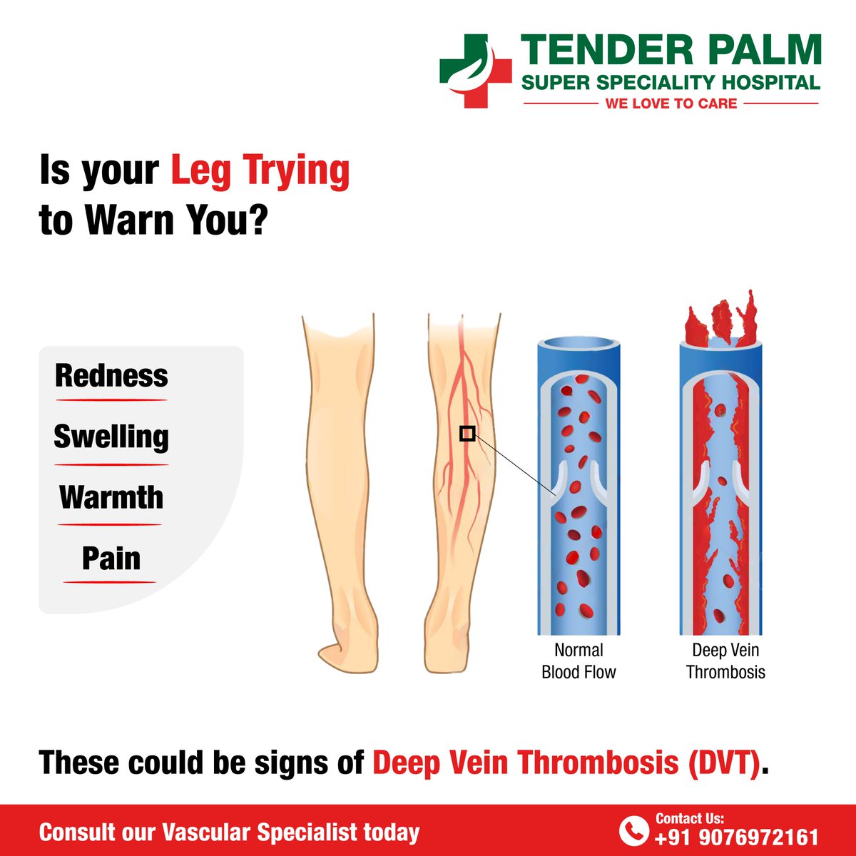 Leg pain, swelling, or redness? It could be DVT — don’t ignore the signs, act early!