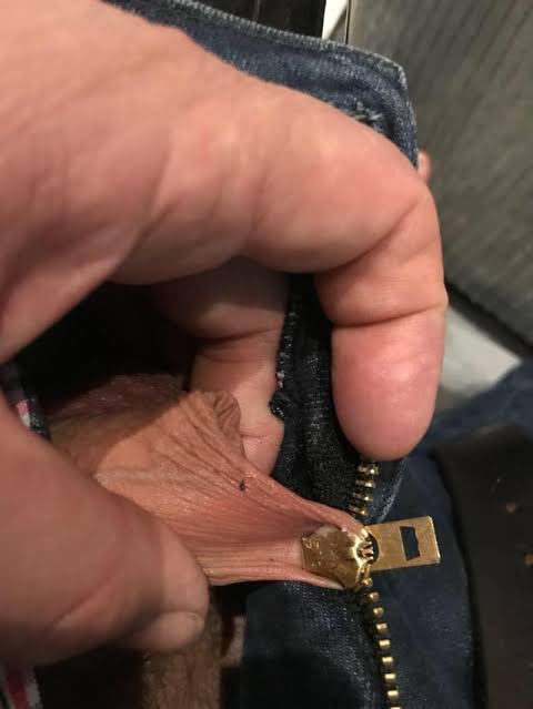 Women will never relate this type of pain😭😭
