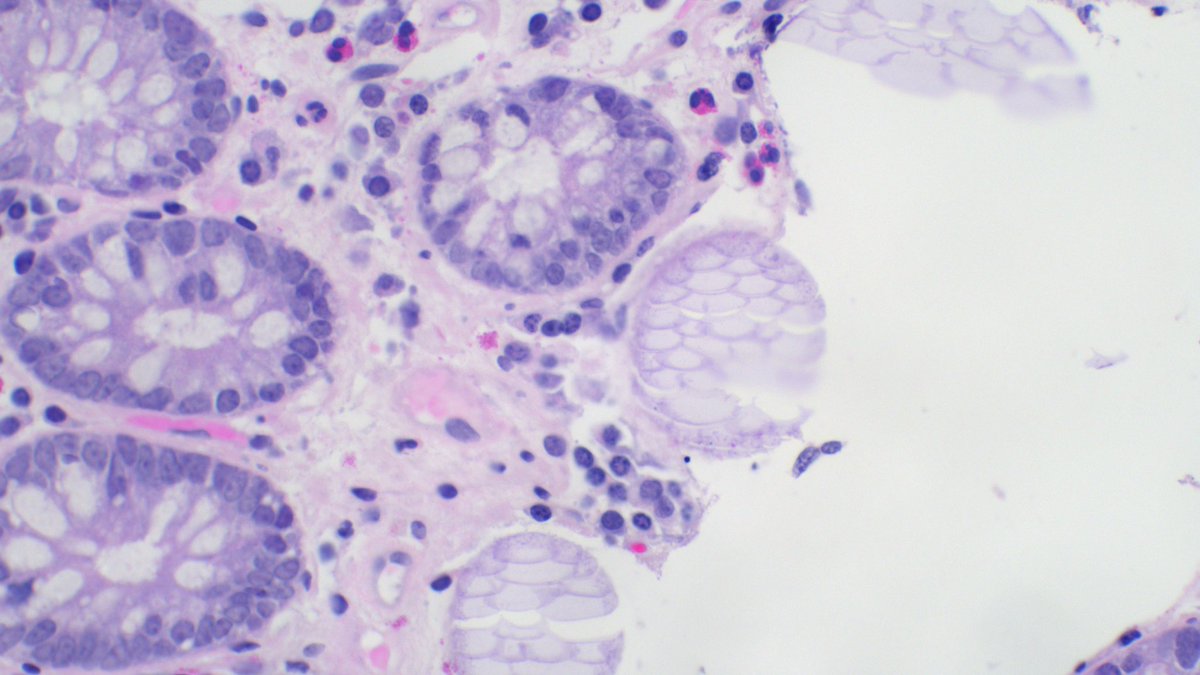 Richard Standish tweet media