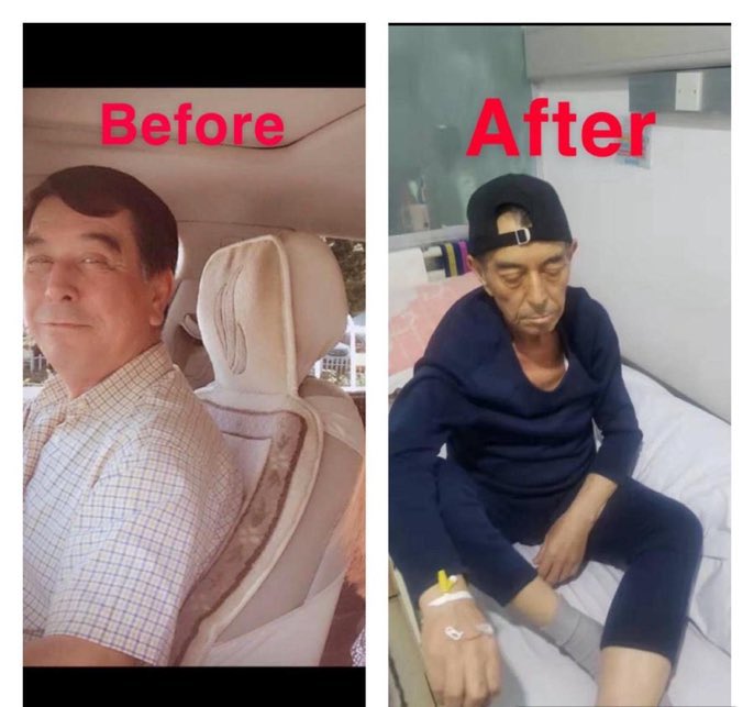 Doğu Türkistan’da 1 yıl boyunca toplama kamplarında ilkence gören Uygur Türkü hastenede görüntülendi.