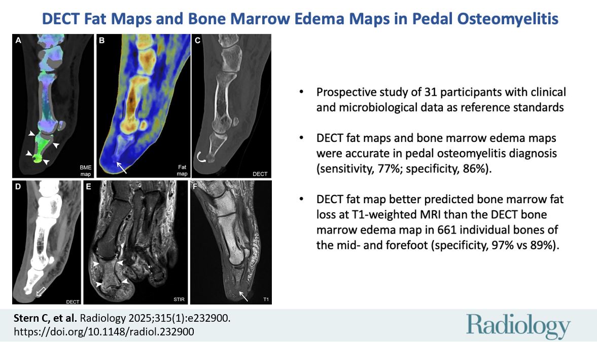 SutterBalgrist's tweet image. #JustPublished: Novel DECT Fat Maps for diagnosing Osteomyelitis.
Dual Energy CT Fat Maps can be used together with Bone Marrow Edema Maps for detecting #Osteomyelitis
👉Read the article here: pubs.rsna.org/doi/10.1148/ra…
@derbalgrist @BalgristCampus @radiology_rsna @RSNA #MSKrad