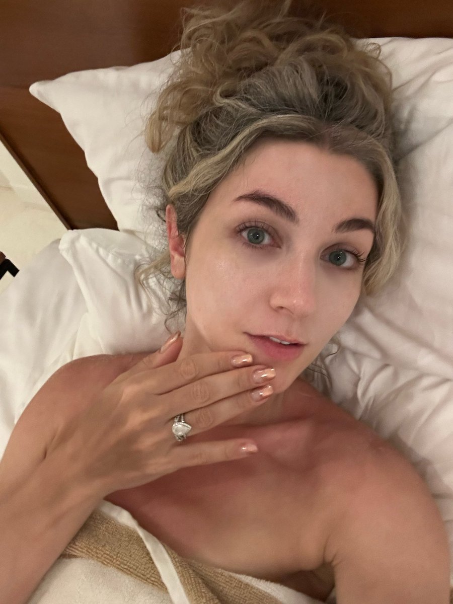 На фото - лицо, которое гуляло строго в SPF 50, без кепки и солнечных очков, декольте, вверх которым одна тупая женщина уснула на пляже, и загоревшая рука, на которой этого самого SPF и не было. Но вы продолжайте верить в заговоры корпораций и неэффективность санблоков 👌🏻