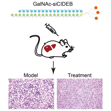 Bruno Ramos-Molina, PhD (@brunorm84) on Twitter photo Targeting CIDEB alleviates liver steatosis and fibrosis in mouse #MASH models <a href="/MolTherapy/">Molecular Therapy</a> cell.com/molecular-ther… Targeting CIDEB alleviates liver steatosis and fibrosis in mouse #MASH models <a href="/MolTherapy/">Molecular Therapy</a> cell.com/molecular-ther…