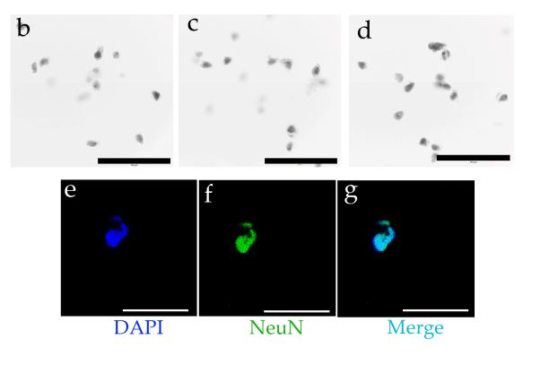 #newpaper
☀️☀️Welcome to read the paper by Raúl Alelú-Paz et al. | A Refined Approach to #Isolate #Interneurons for High-Validity Epigenetic Studies in #Human #BrainTissue
👉mdpi.com/2409-9279/8/3/…
#epigenetics #neuroscience #DNA #molecularbiology #cellularbiology