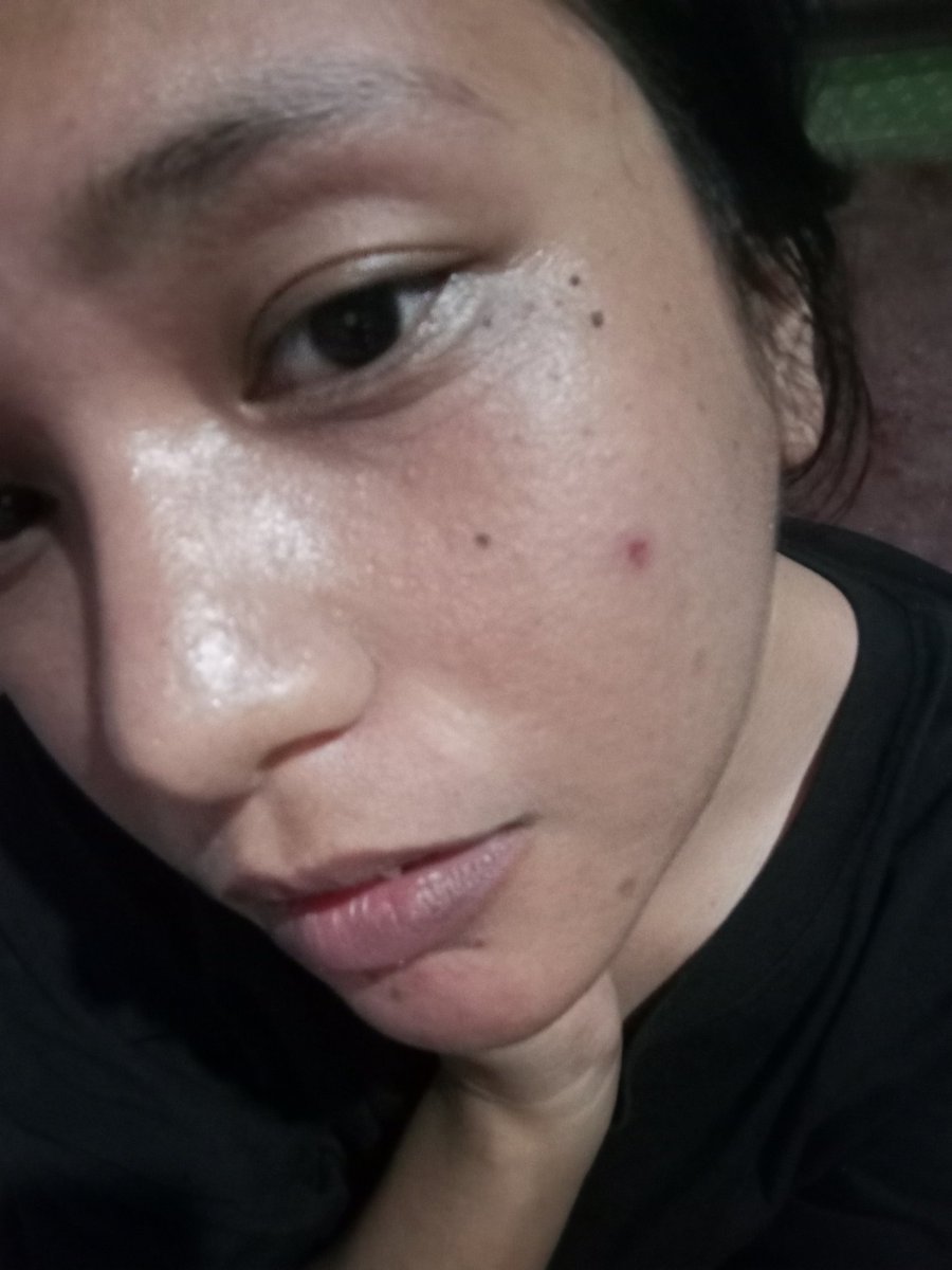 Di ko alam. Pero Ang Ganda ko sa pics na to kahit kita lahat mga kalat ko sa Mukha. 😂🥴

For documentation ko to Kasi Dami Kong skincare tinatry . Chinicheck ko if effective. Hahahhaha.. balikan ko tong pics na to sa December 👉🏻👈🏻