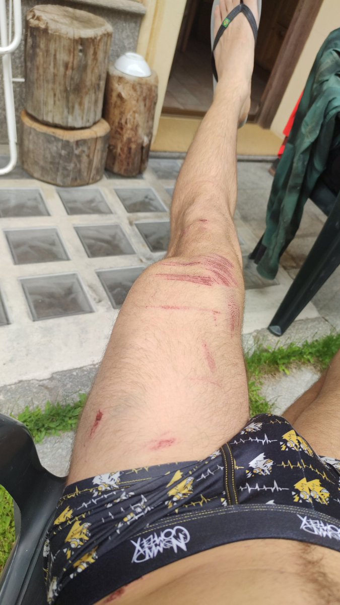 Went biking... 

I think I sent it a lil too fucking hard 😅