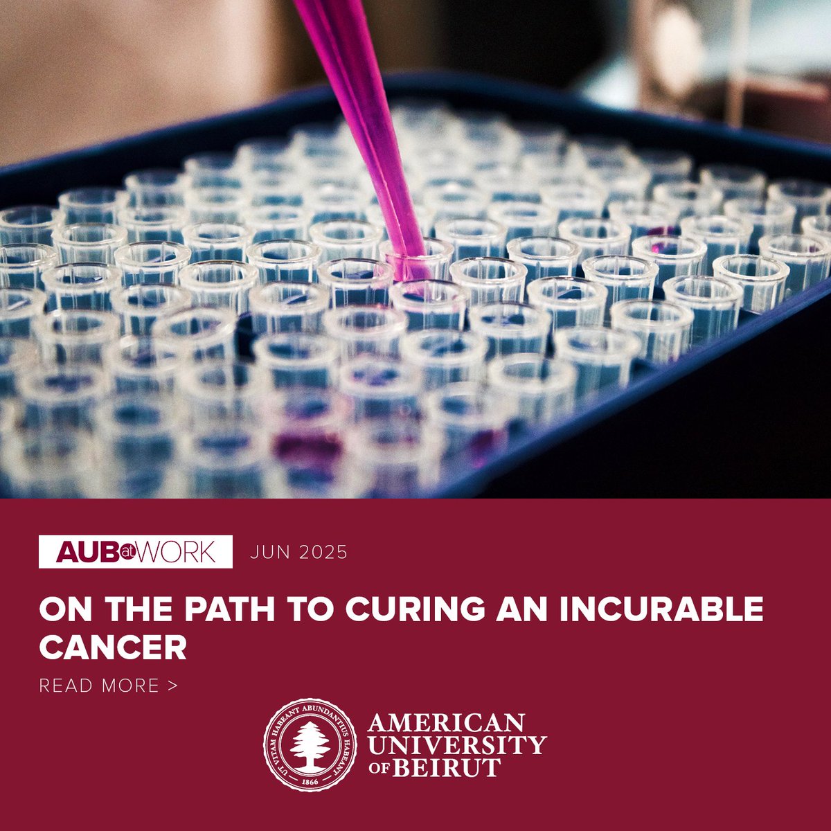 A leukemia once thought incurable is now on the brink of a cure—thanks to AUB's Dr. Ali Bazarbachi. His groundbreaking research is transforming outcomes for patients with adult T-cell leukemia/lymphoma. Learn more: tr.ee/ATLcure