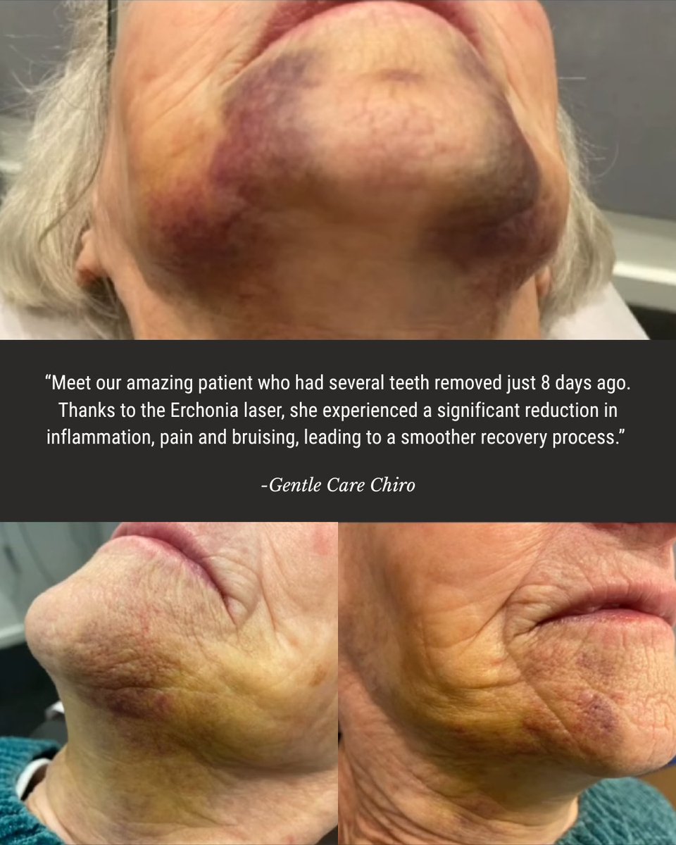 Erchonia tweet media