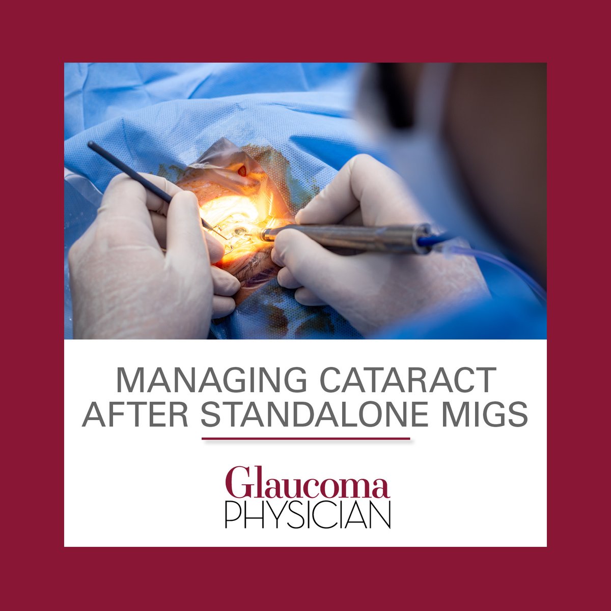 Steven R. Sarkkisian Jr, MD, explains how a deliberate and proactive surgical strategy is necessary to achieve optimal outcomes. Read more: ow.ly/27Vq50W6yvh
#GlaucomaPhysician #GPnews #interventionalglaucoma #MIGS #Conexiant