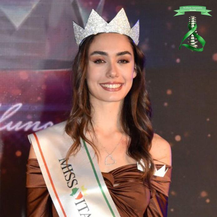 We want to share the story of Lavinia. When she was crowned #MissItalia, she had been wearing a #brace for 5 years: “Thanks to #ISICO and my determination, I’ve improved a lot. Today, even though my #back isn’t completely straight, I now love and #accept my body as it is.”