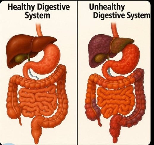 66% of people suffer from poor digestion.

It's the reason why you are:

- Full of gas
- Swollen
- Gaining weight

And no, this is not normal.

Here's the real cause of digestive problems (and how to fix them naturally):